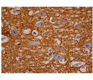 alpha Synuclein Antibody (2B2D1) - Immunohistochemistry - Image 350542 