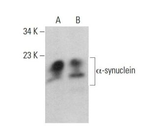 alpha Synuclein Antibody (3G282) - Western Blotting - Image 379608 