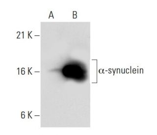 alpha Synuclein Antibody (3H2897) - Western Blotting - Image 39343 