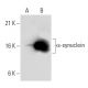 alpha Synuclein Antibody (3H2897) - Western Blotting - Image 39343 