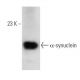 alpha Synuclein Antibody (3H2897) - Western Blotting - Image 65388