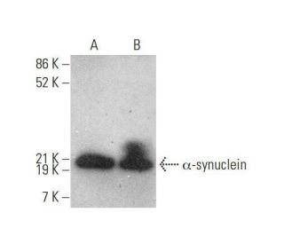 western blotting image from recommended alpha Synuclein (211) monoclonal antibody replacement. Image 350707
