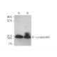 western blotting image from recommended alpha Synuclein (211) monoclonal antibody replacement. Image 350707
