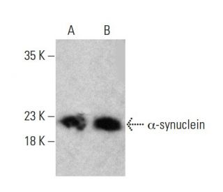 alpha Synuclein Antibody (D-10) - Western Blotting - Image 386111 