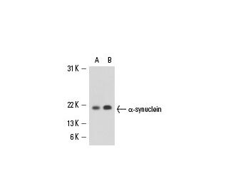 alpha Synuclein Antibody (Syn 204) - Western Blotting - Image 15642 