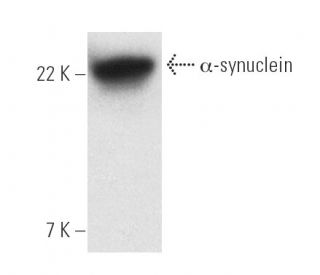 alpha Synuclein Antibody (211) - Western Blotting - Image 4424