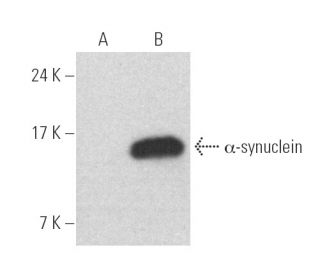 alpha Synuclein Antibody (D-10) - Western Blotting - Image 390097