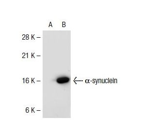 alpha / beta-synuclein (3G283): sc-69967. Western blot analysis of alpha-synuclein expression in... 