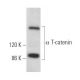 α T-catenin Antibody (B-6) - Western Blotting - Image 368987
