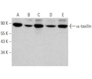 &alpha;-taxilin Antibody (B-9) - Western Blotting - Image 374706 