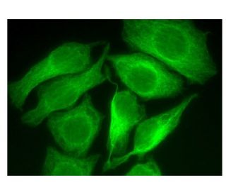 alpha Tubulin Antibody TU 02 SCBT Santa Cruz Biotechnology