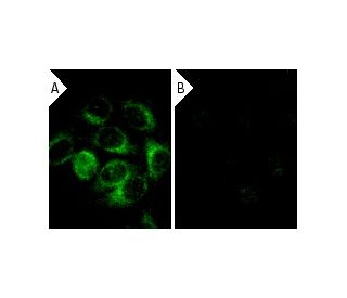 &alpha; Tubulin siRNA (h): sc-29188. Immunofluorescence staining of methanol-fixed, control HeLa (A) and &alpha; Tubulin s 