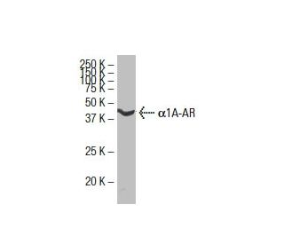 western blotting image from recommended &alpha;1A-AR (4D8) monoclonal antibody replacement. Image 33665