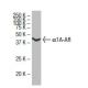 western blotting image from recommended α1A-AR (4D8) monoclonal antibody replacement. Image 33665