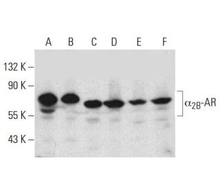 western blotting image from recommended &alpha;2B-AR (G-9) monoclonal antibody replacement. Image 385187