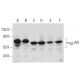 western blotting image from recommended α2B-AR (G-9) monoclonal antibody replacement. Image 385187