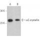 αC-crystallin Antibody (H-5) - Western Blotting - Image 367094 