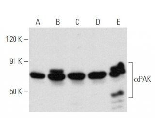western blotting image from recommended &alpha;PAK (A-6) monoclonal antibody replacement. Image 354845