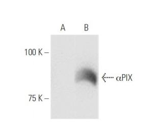 &alpha;PIX Antibody (2E5) - Western Blotting - Image 347602 