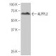 ALPPL2 Antibody (9-YD35) - Western Blotting - Image 64839 