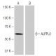 ALPPL2 Antibody (9-YD35) - Western Blotting - Image 64840