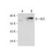 ALS Antibody (E-2) - Western Blotting - Image 281798