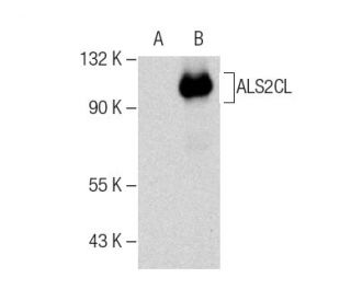 ALS2CL Antibody (E-8) - Western Blotting - Image 282601