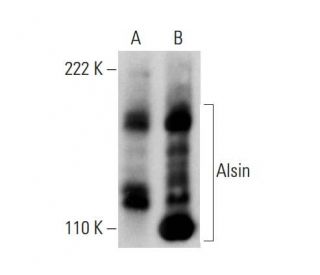 Alsin Antibody (2J10) - Western Blotting - Image 384440 