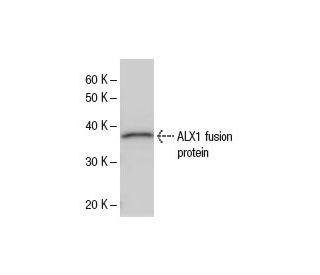 ALX1 Antibody (3329D3a) - Western Blotting - Image 47867