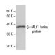 ALX1 Antibody (3329D3a) - Western Blotting - Image 47867