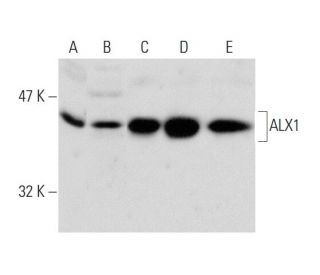 ALX1 Antibody (96K) - Western Blotting - Image 138559 