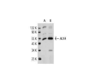ALX4 Antibody (KAB4) - Western Blotting - Image 11015 