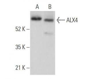 ALX4 Antibody (KAB4) - Western Blotting - Image 362988Each CRISPR/Cas9 Knockout (KO) Plasmid product consists of a pool of 3 plasmids designed to ensure identification and cleavage of a specific gene for maximum knockout efficiency. Each plasmid encodes a unique 20 nt sequence derived from the GeCKO (v2) library.
