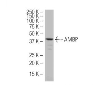 AMBP Antibody (532) - Western Blotting - Image 33598SAM Transcription Activation: SAM system utilizing dCas9-VP64, MS2-P65-HSF1, and sgRNA for precise gene transcription activation.