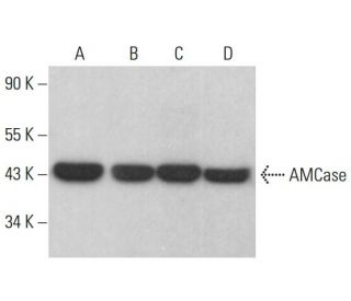 AMCase Antibody (E-11) - Western Blotting - Image 383804 