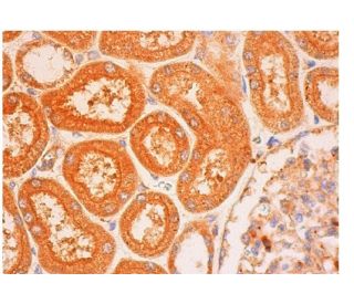 immunohistochemistry image from recommended Ameloblastin (H-2) monoclonal antibody replacement. Image 313278