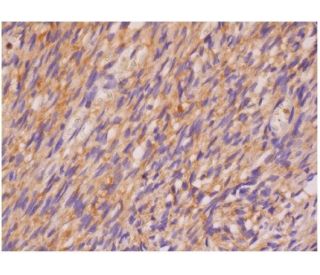 AMIGO1 Antibody (H-4) - Immunohistochemistry - Image 286451 