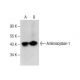 Aminoacylase-1 Antibody (F-6) - Western Blotting - Image 282202 