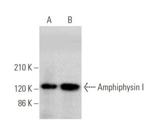Amphiphysin I Antibody (13) - Western Blotting - Image 374423 