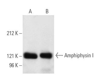 Amphiphysin I Antibody (8) - Western Blotting - Image 4072 