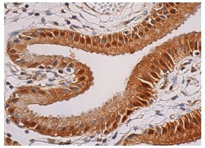 AMPK alpha 1/2 Antibody (D-6) | SCBT - Santa Cruz Biotechnology