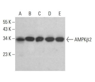 western blotting image from recommended AMPK&beta;2 (C-7) monoclonal antibody replacement. Image 383763
