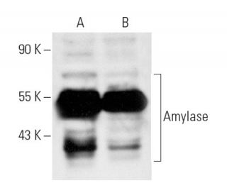 western blotting image from recommended Amylase (G-10) monoclonal antibody replacement. Image 10422