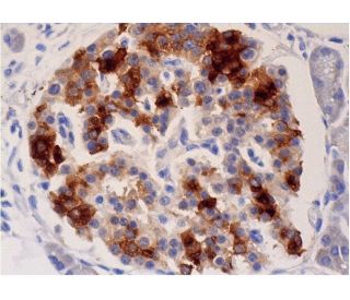 immunohistochemistry image from recommended Amylin (E-5) monoclonal antibody replacement. Image 286537