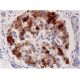 Este anticorpo policlonal foi descontinuado. Consulta o nosso anticorpo monoclonal <a href="amylin-antibody-e-5">Amylin (E-5)</a> recomendado (dados de amostra apresentados). immunohistochemistry image from recommended Amylin (E-5) monoclonal antibody replacement. Image 286537