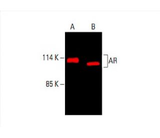 Androgen Receptor Antibody (441) - Western Blotting - Image 394021