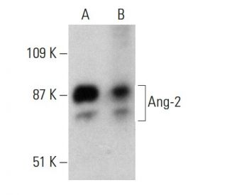 western blotting image from recommended Angiopoietin 2/Ang-2/ANGPT2 (F-1) monoclonal antibody replacement. Image 388039