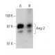western blotting image from recommended Angiopoietin 2/Ang-2/ANGPT2 (F-1) monoclonal antibody replacement. Image 388039