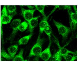 immunofluorescence image from recommended Ang-4 (A-6) monoclonal antibody replacement. Image 296779