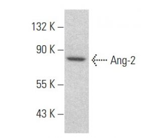 Angiopoietin 2/Ang-2/ANGPT2 Antibody (H-11) - Western Blotting - Image 354426Each CRISPR/Cas9 Knockout (KO) Plasmid product consists of a pool of 3 plasmids designed to ensure identification and cleavage of a specific gene for maximum knockout efficiency. Each plasmid encodes a unique 20 nt sequence derived from the GeCKO (v2) library.
